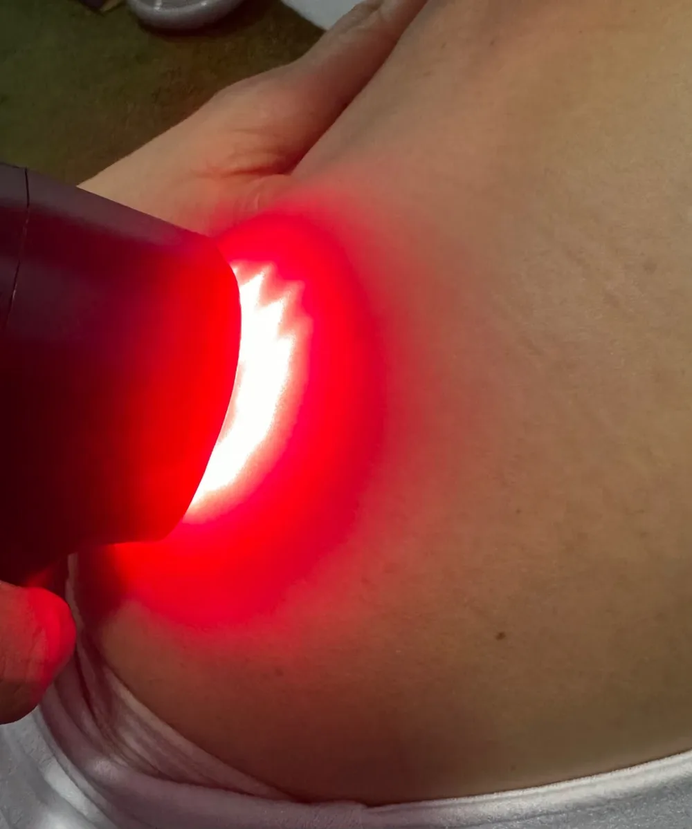 Fotobiomodulação com laser